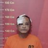 Usai Curi AC, Abang Ini Jadi Bahan Praktek Oplas Warga Medan Area