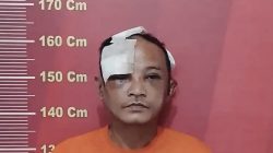 Usai Curi AC, Abang Ini Jadi Bahan Praktek Oplas Warga Medan Area