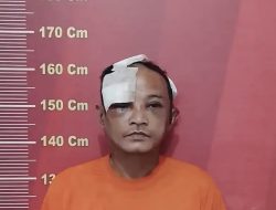 Usai Curi AC, Abang Ini Jadi Bahan Praktek Oplas Warga Medan Area